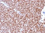 NKX2.2 (Neuroendocrine & Ewing s Sarcoma Marker) (rNX2/294), CF640R conjugate, 0.1mg/mL