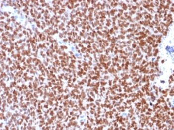 NKX2.2 (Neuroendocrine & Ewing s Sarcoma Marker) (rNX2/294), CF640R conjugate, 0.1mg/mL