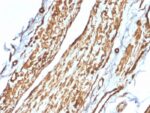 Vinculin (Marker of Age-related Macular Degeneration)(VCL/2575), 0.2mg/mL 1 view_image-915