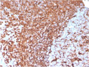 Vimentin (Mesenchymal Cell Marker)(VIM/3736), CF568 conjugate, 0.1mg/mL