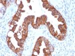 Cytokeratin 7 (Glandular and Transitional Epithelial Marker) (rOV-TL12/30), 0.2mg/mL 1 view_image-92