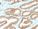 YBX1 / Y-box Binding Protein 1 / YB-1 (Tumor Biomarker)(YBX1/2430), CF568 conjugate, 0.1mg/mL