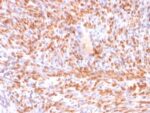 Calponin-1 (Smooth Muscle Marker) (rCNN1/832), CF568 conjugate, 0.1mg/mL