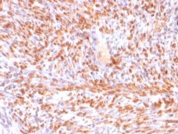 Calponin-1 (Smooth Muscle Marker) (rCNN1/832), CF568 conjugate, 0.1mg/mL